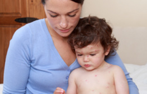 Neštovice - Jak je poznat a léčit?