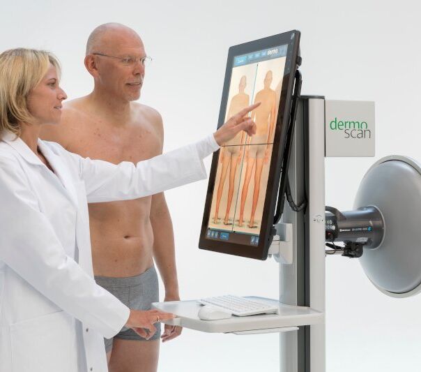 Jak probíhá vyšetření DermoScan?